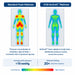Pressure map comparison between standard foam mattress and IC30 ActiveX showing reduced pressure points under 19 mmHg for high-risk Waterlow 20+ patients with color gradient from red to green