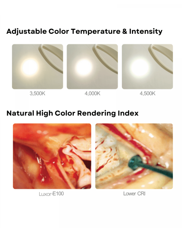 Luxor 100 LED Exam/Procedure Light | Infinium Medical
