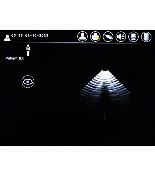 Professional Bladder Scanner | Medacure