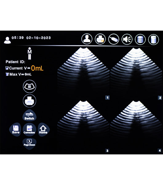 Professional Bladder Scanner | Medacure
