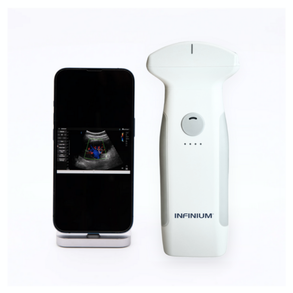 VioScan C7 Convex Hand Held Ultrasound Device | Infinium Medical
