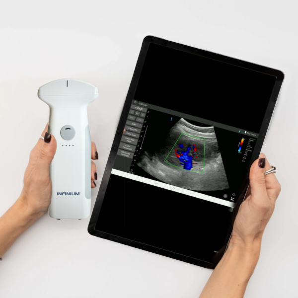 VioScan C7 Convex Hand Held Ultrasound Device | Infinium Medical