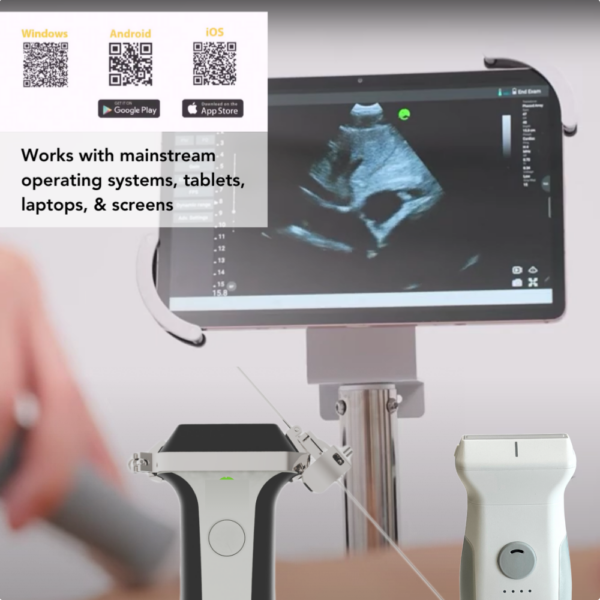 VioScan L2 Wireless Hand Held Ultrasound Machine | Infinium Medical