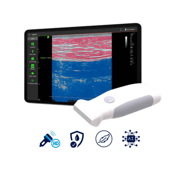 VioScan L2 Wireless Hand Held Ultrasound Machine | Infinium Medical