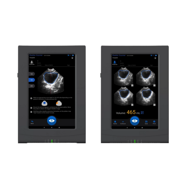 VioScan Portable Bladder Scanner with 10.3 Inch Touchscreen (2026 Edition) | Infinium Medical