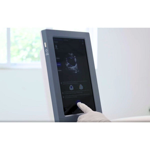 VioScan Portable Bladder Scanner with 10.3 Inch Touchscreen (2026 Edit